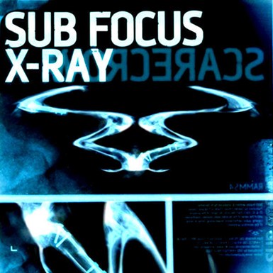 X Ray Ringtone Download Free